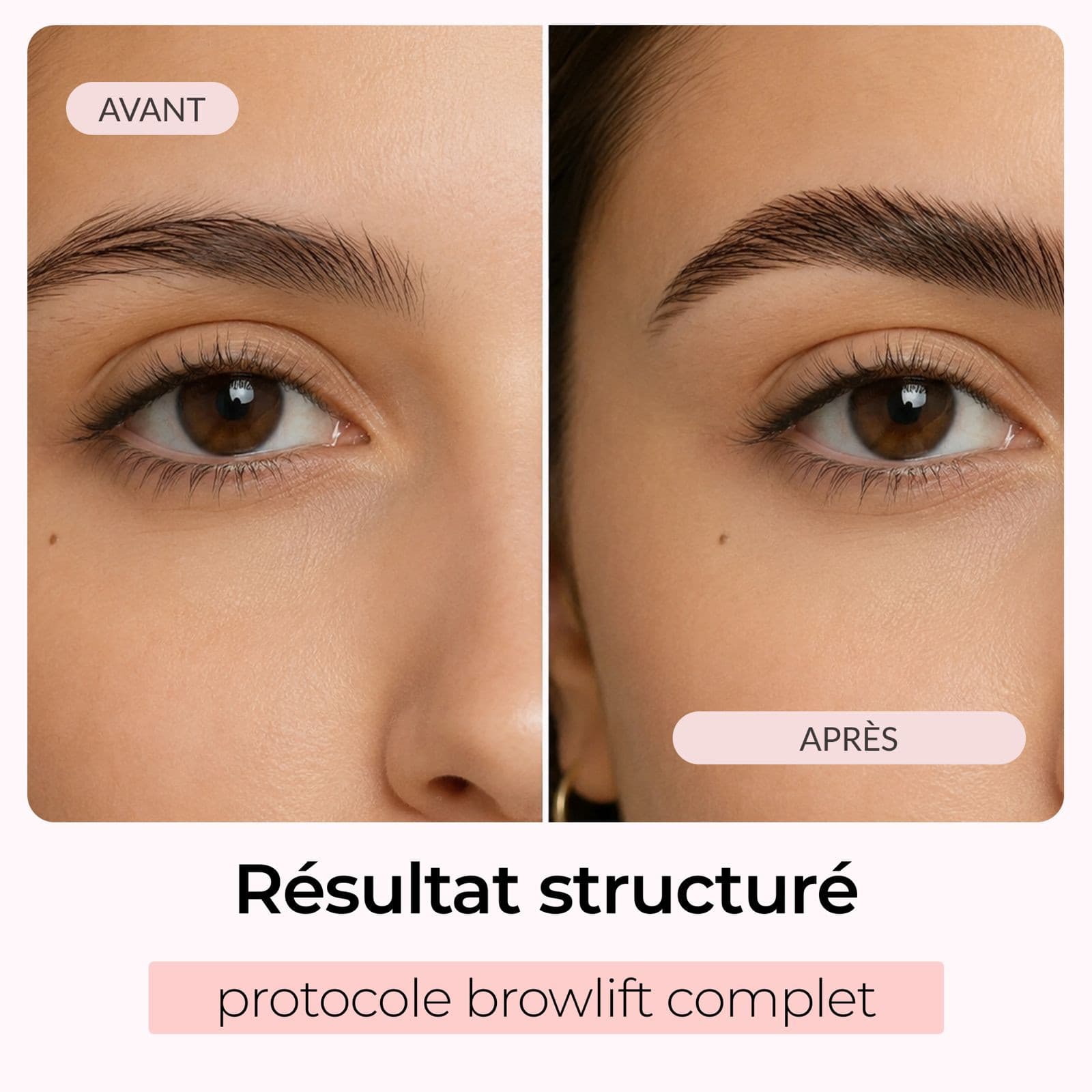 KIT BROWLIFT